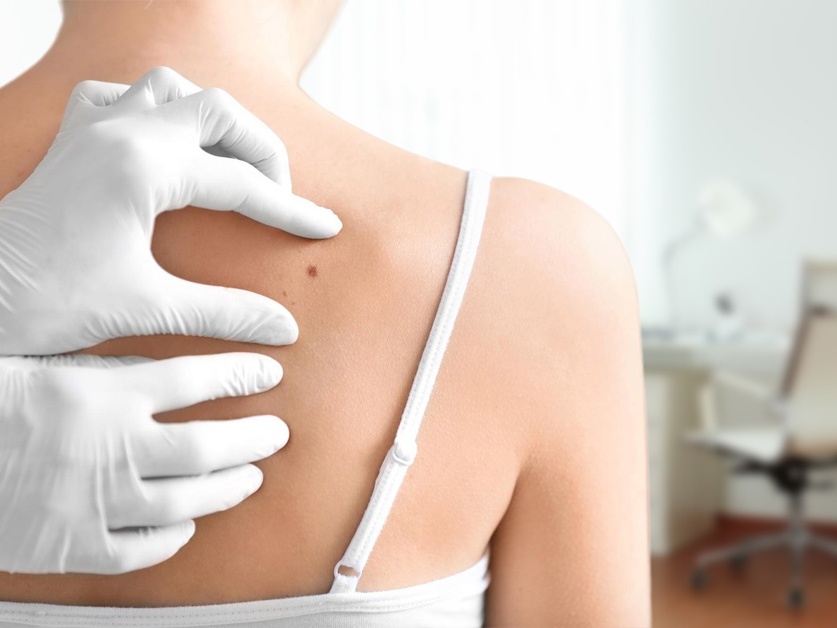 Kožní ambulance - MUDr. Zlatuše Holoubková